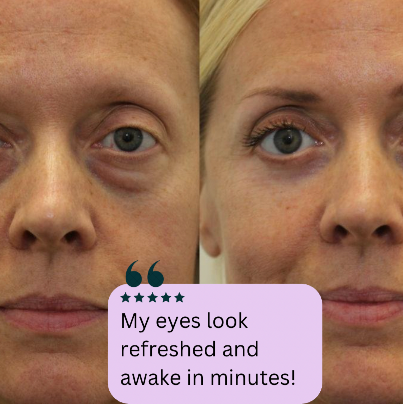 Liftique™ - Instant Eye Tightener