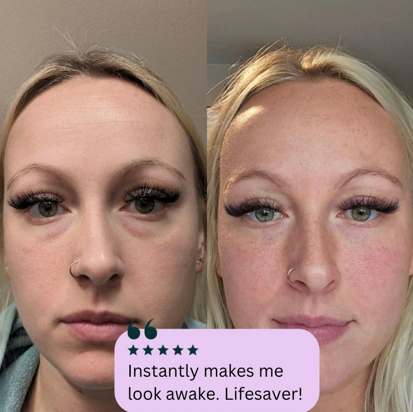 Liftique™ - Instant Eye Tightener