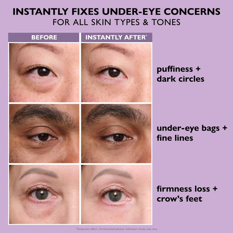 Liftique™ - Instant Eye Tightener