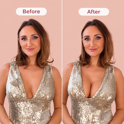 Celara™ Viral Lift Bra